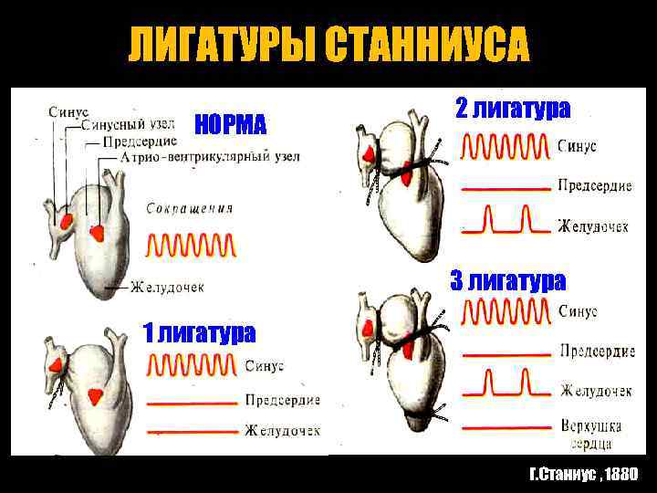 Что такое лигатуры в ворде