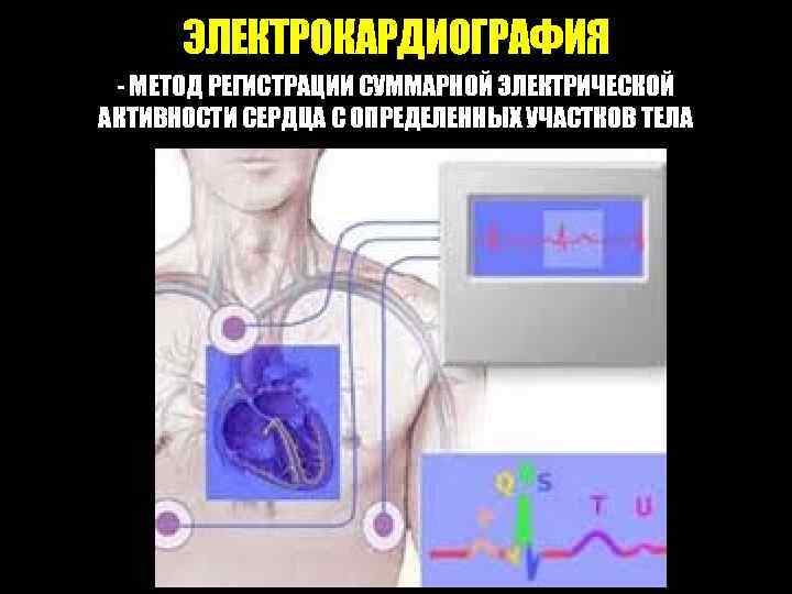 ЭЛЕКТРОКАРДИОГРАФИЯ - МЕТОД РЕГИСТРАЦИИ СУММАРНОЙ ЭЛЕКТРИЧЕСКОЙ АКТИВНОСТИ СЕРДЦА С ОПРЕДЕЛЕННЫХ УЧАСТКОВ ТЕЛА 