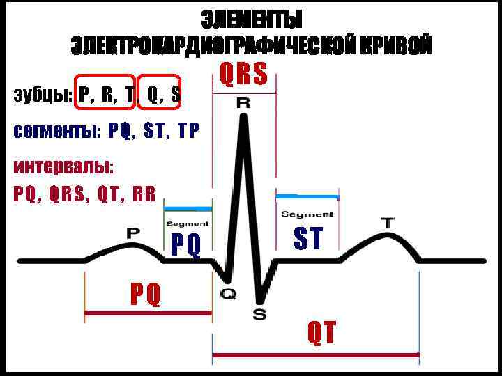 ЭЛЕМЕНТЫ ЭЛЕКТРОКАРДИОГРАФИЧЕСКОЙ КРИВОЙ зубцы: P , R , T , Q , S QRS