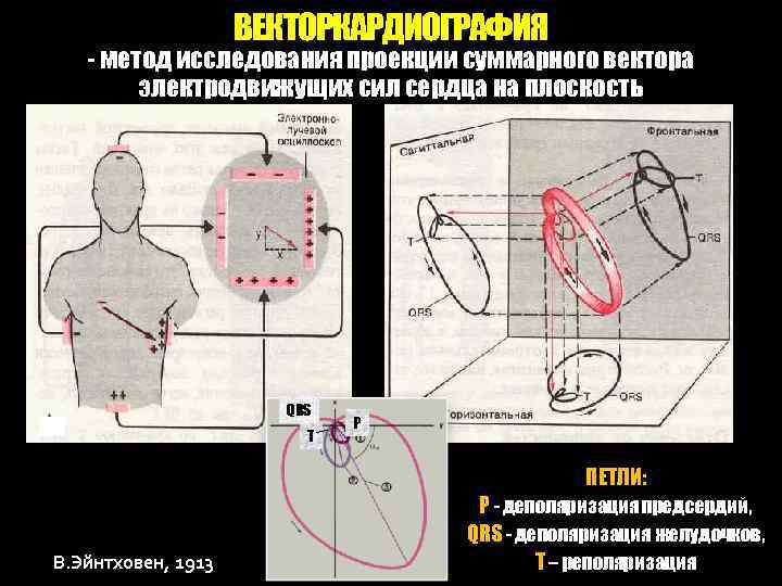 ВЕКТОРКАРДИОГРАФИЯ - метод исследования проекции суммарного вектора электродвижущих сил сердца на плоскость QRS Т