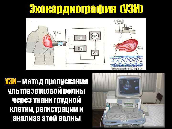 Эхокардиография (УЗИ) УЗИ – метод пропускания ультразвуковой волны через ткани грудной клетки, регистрации и