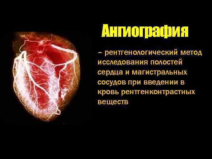 Ангиография – рентгенологический метод исследования полостей сердца и магистральных сосудов при введении в кровь