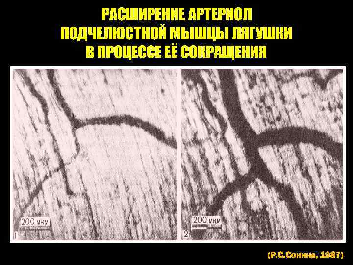 РАСШИРЕНИЕ АРТЕРИОЛ ПОДЧЕЛЮСТНОЙ МЫШЦЫ ЛЯГУШКИ В ПРОЦЕССЕ ЕЁ СОКРАЩЕНИЯ (Р. С. Сонина, 1987) 