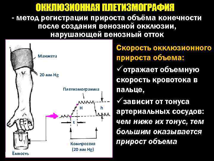 Измерение кровотока. Плетизмография физиология. Окклюзионная плетизмография. Венозная окклюзионная плетизмография. Импедансная окклюзионная плетизмография.