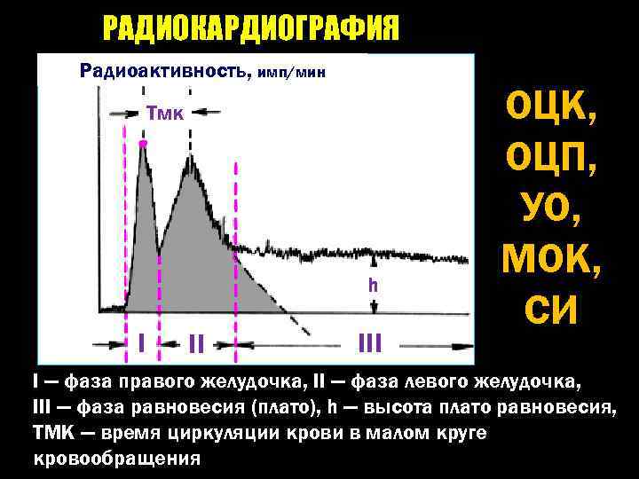 РАДИОКАРДИОГРАФИЯ Радиоактивность, имп/мин Тмк h I II III ОЦК, ОЦП, УО, МОК, СИ I