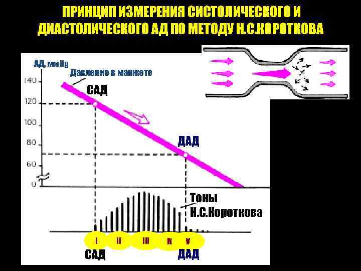  ПРИНЦИП ИЗМЕРЕНИЯ СИСТОЛИЧЕСКОГО И ДИАСТОЛИЧЕСКОГО АД ПО МЕТОДУ Н. С. КОРОТКОВА Давление в