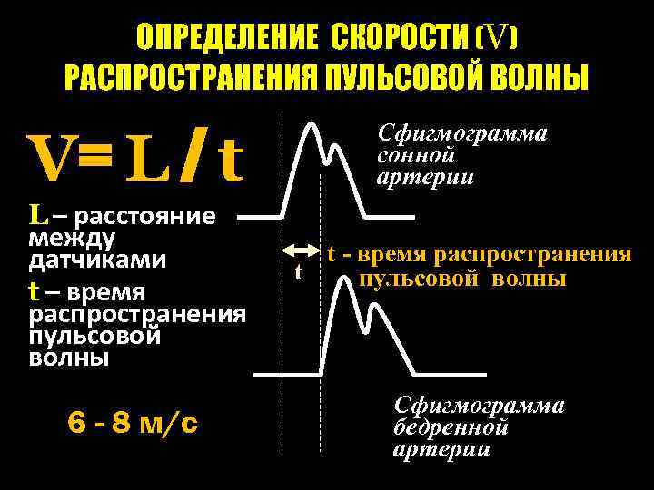 Каротидно феморальная спв. Скорость распространения пульсовой волны схема. Определение скорости распространения пульсовой волны. Скорость пульсовой волны. Оценка скорости пульсовой волны.