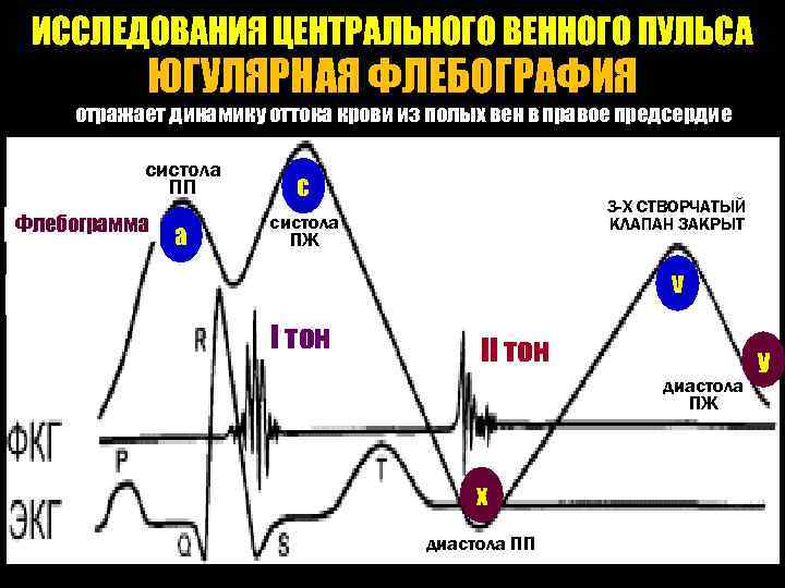 ИССЛЕДОВАНИЯ ЦЕНТРАЛЬНОГО ВЕННОГО ПУЛЬСА ЮГУЛЯРНАЯ ФЛЕБОГРАФИЯ отражает динамику оттока крови из полых вен в