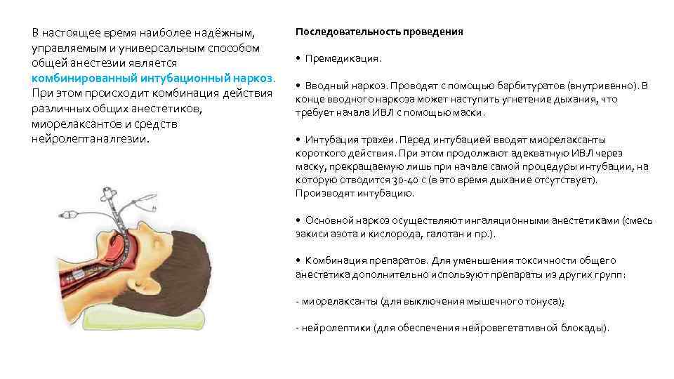 В настоящее время наиболее надёжным, управляемым и универсальным способом общей анестезии является комбинированный интубационный