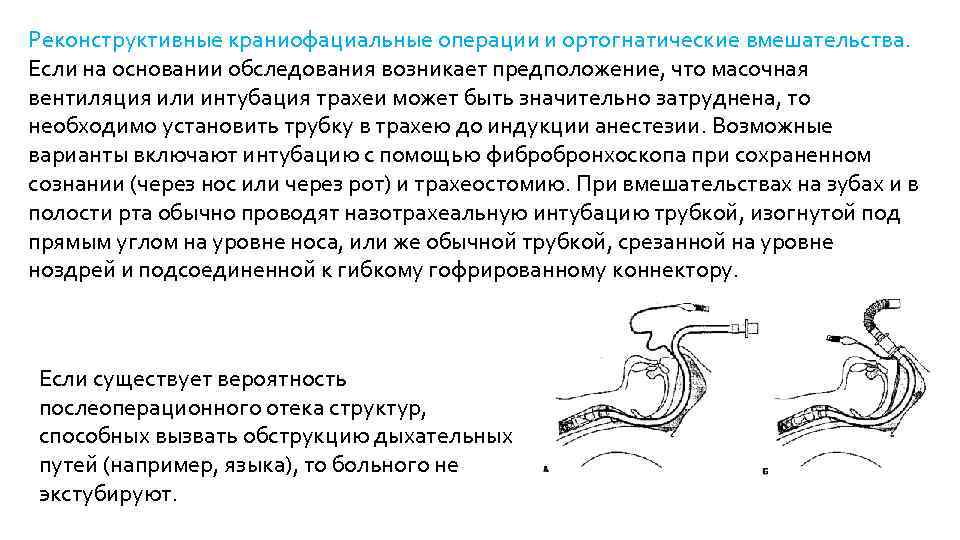 Реконструктивные краниофациальные операции и ортогнатические вмешательства. Если на основании обследования возникает предположение, что масочная
