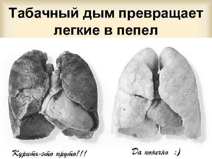 Табачный дым превращает легкие в пепел 