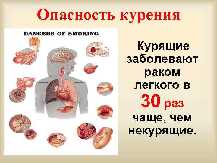 Опасность курения Курящие заболевают раком легкого в 30 раз чаще, чем некурящие. 