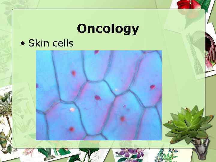 Oncology • Skin cells 
