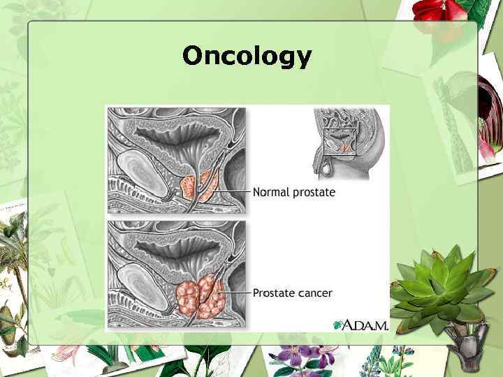 Oncology 