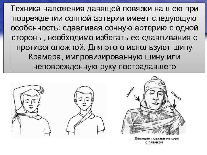 Техника наложения давящей повязки на шею при повреждении сонной артерии имеет следующую особенность: сдавливая