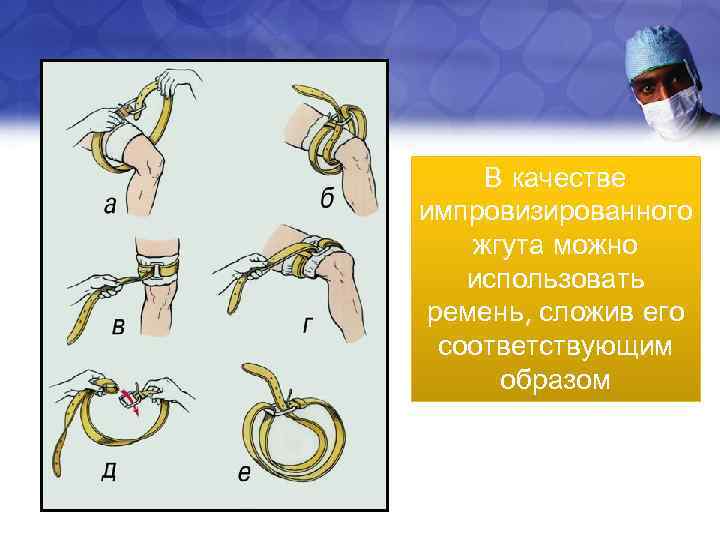 В качестве импровизированного жгута можно использовать ремень, сложив его соответствующим образом 