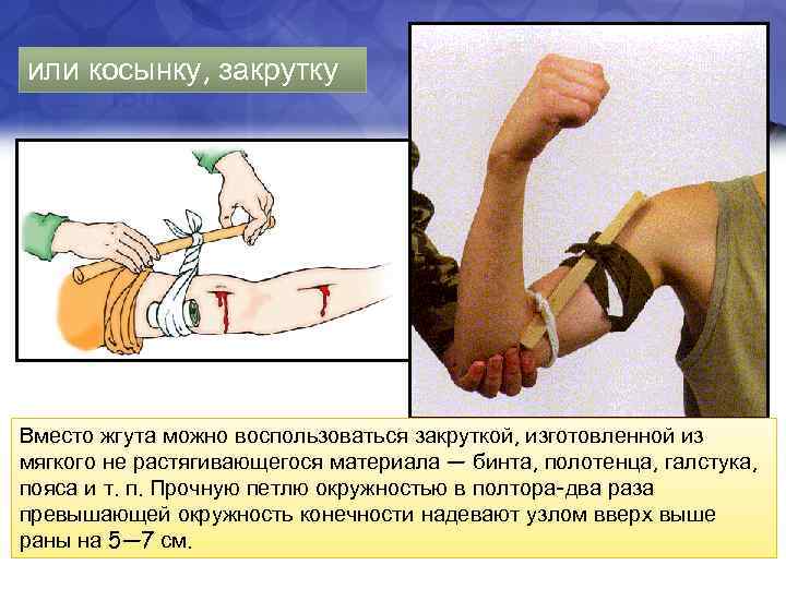 или косынку, закрутку Вместо жгута можно воспользоваться закруткой, изготовленной из мягкого не растягивающегося материала