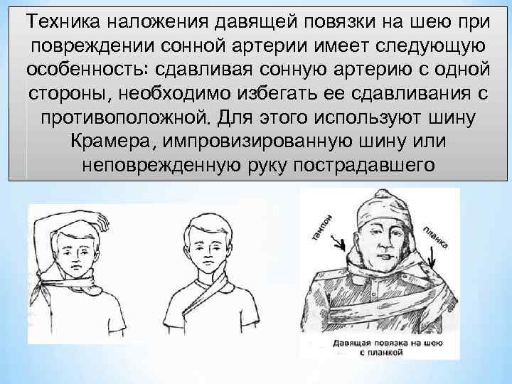 Техника наложения давящей повязки на шею при повреждении сонной артерии имеет следующую особенность: сдавливая