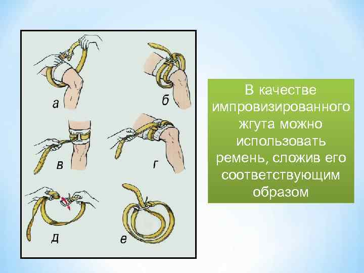 В качестве импровизированного жгута можно использовать ремень, сложив его соответствующим образом 