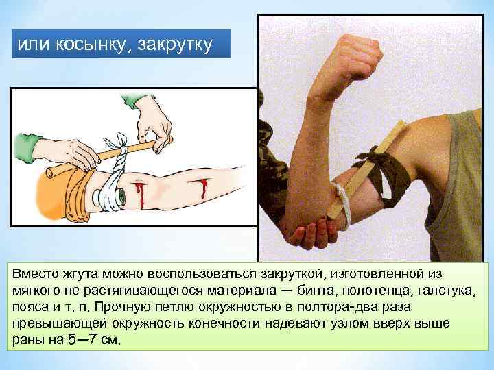 или косынку, закрутку Вместо жгута можно воспользоваться закруткой, изготовленной из мягкого не растягивающегося материала