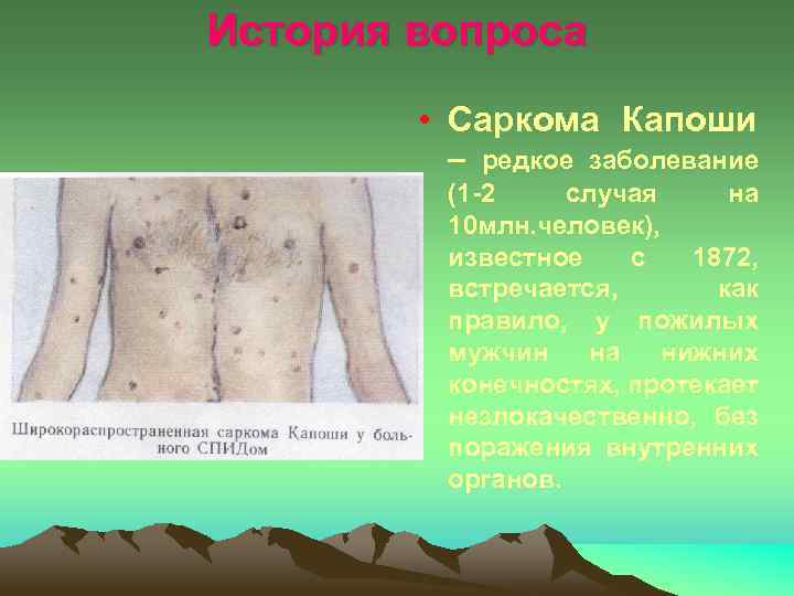 История вопроса • Саркома Капоши – редкое заболевание (1 -2 случая на 10 млн.