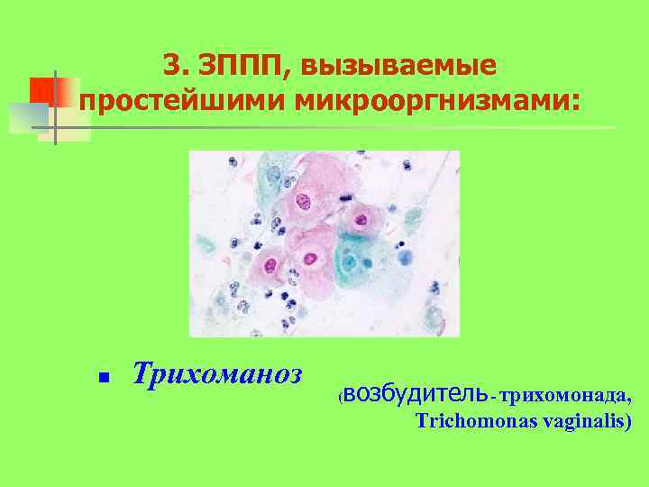 3. ЗППП, вызываемые простейшими микрооргнизмами: n Трихоманоз ( возбудитель - трихомонада, Trichomonas vaginalis) 