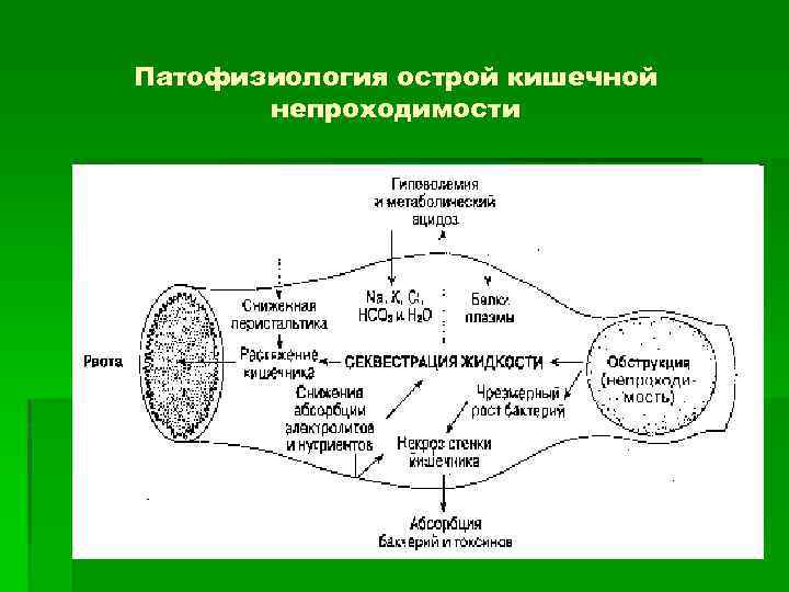 Патофизиология острой кишечной непроходимости 