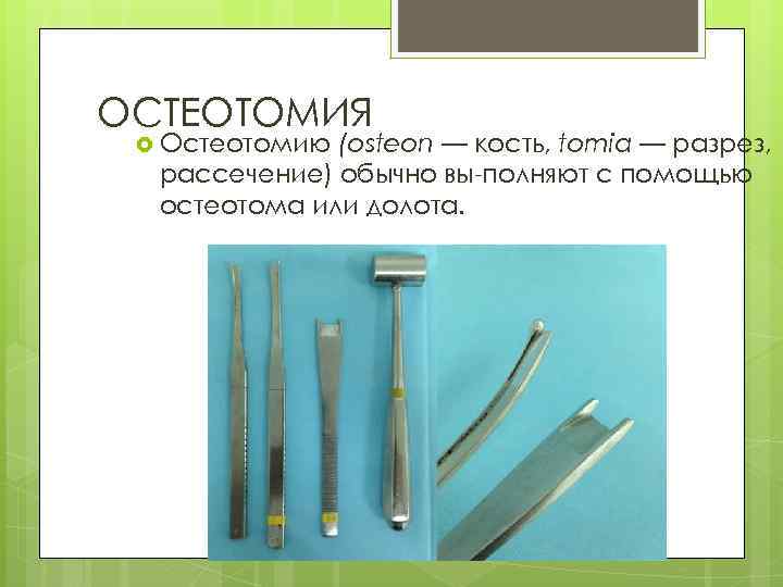 ОСТЕОТОМИЯ Остеотомию (osteon — кость, tomia — разрез, рассечение) обычно вы полняют с помощью