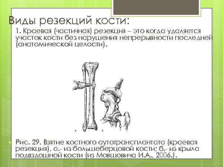 Виды резекций кости: 1. Краевая (частичная) резекция – это когда удаляется участок кости без