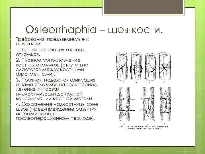 Osteorrhaphia – шов кости. Требования, предъявляемые к шву кости: 1. Точная репозиция костных отломков.