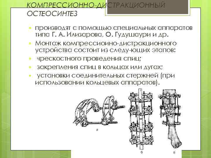 КОМПРЕССИОННО-ДИСТРАКЦИОННЫЙ ОСТЕОСИНТЕЗ производят с помощью специальных аппаратов типа Г. А. Илизарова, О. Гудушаури и