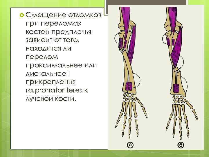  Смещение отломков при переломах костей предплечья зависит от того, находится ли перелом проксимальнее