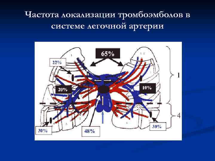 Частота локализации тромбоэмболов в системе легочной артерии 