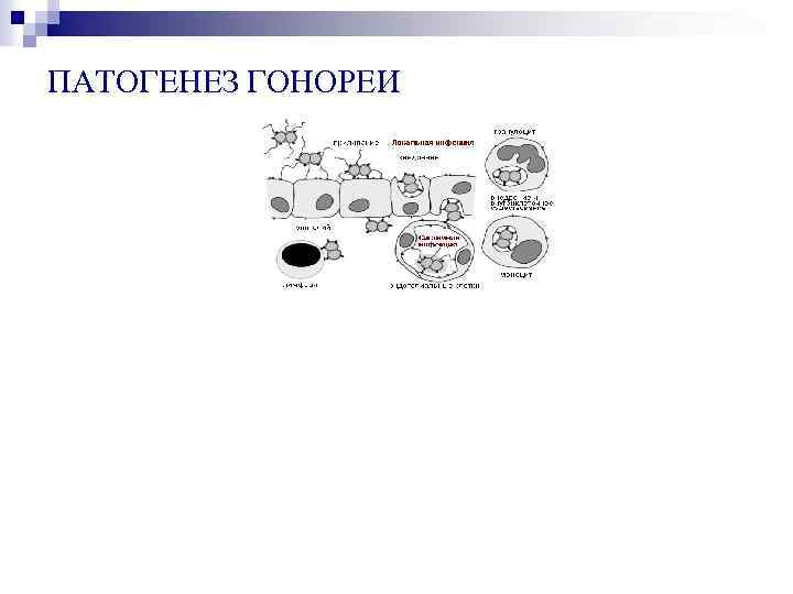 ПАТОГЕНЕЗ ГОНОРЕИ 