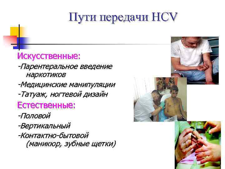 Пути передачи HCV Искусственные: -Парентеральное введение наркотиков -Медицинские манипуляции -Татуаж, ногтевой дизайн Естественные: -Половой