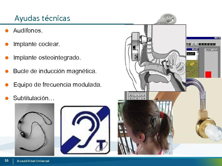 Ayudas técnicas l Audífonos. l Implante coclear. l Implante osteointegrado. l Bucle de inducción