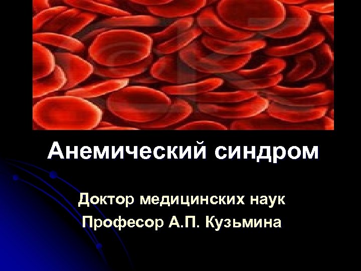 Анемический синдром Доктор медицинских наук Професор А. П. Кузьмина 