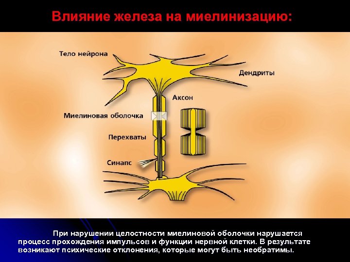 Влияние железа на миелинизацию: При нарушении целостности миелиновой оболочки нарушается процесс прохождения импульсов и