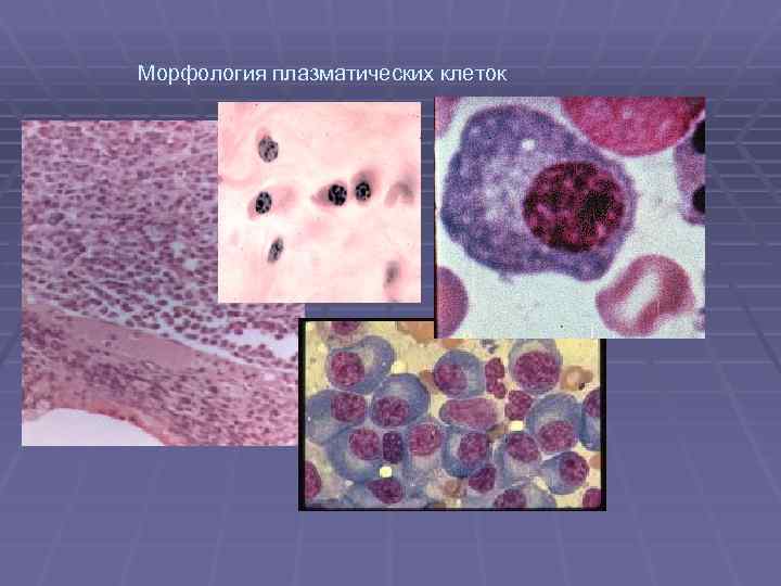 Морфология плазматических клеток 