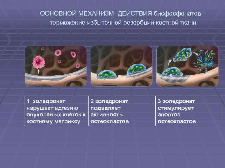 ОСНОВНОЙ МЕХАНИЗМ ДЕЙСТВИЯ бисфосфонатов – торможение избыточной резорбции костной ткани 1 золедронат нарушает адгезию