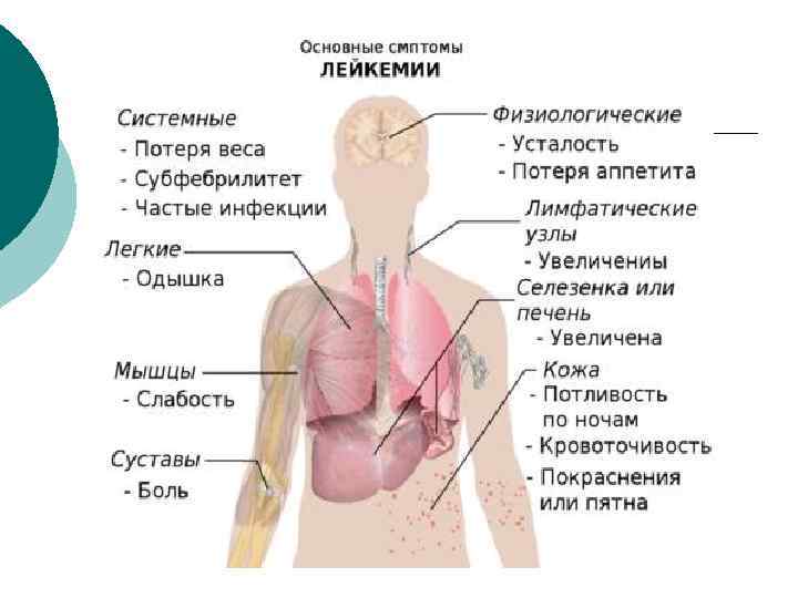 Лейкоз у взрослых. Основные симптомы лейкемии. Основные симптомы лейкоза у детей. Лейкемия симптомы у взрослых. Лейкоз симптомы у взрослых.