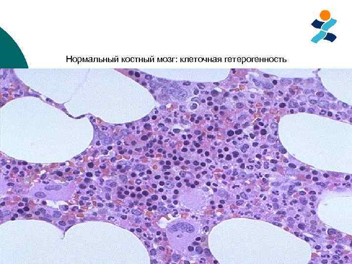 Печени и костного мозга. Клетки костного мозга гистология. Срез красного костного мозга (в препарате Кортиев орган). Красный костный мозг гистология. Нормальный костный мозг гистология.