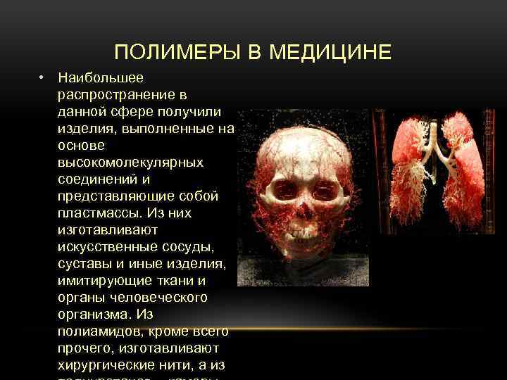 ПОЛИМЕРЫ В МЕДИЦИНЕ • Наибольшее распространение в данной сфере получили изделия, выполненные на основе
