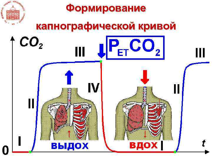 Формирование капнографической кривой 