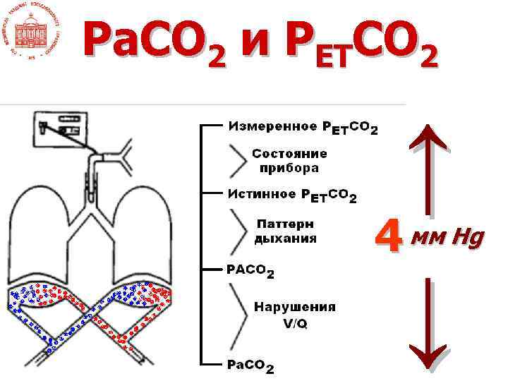 Ра. СО 2 и РЕТСО 2 ↑ 4 ↓ мм Hg 