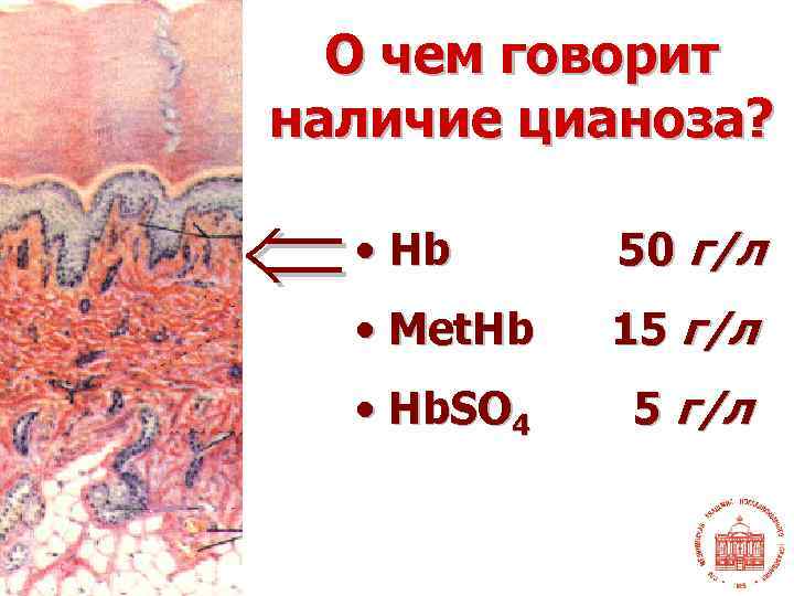 О чем говорит наличие цианоза? • Hb 50 г/л • Met. Hb 15 г/л
