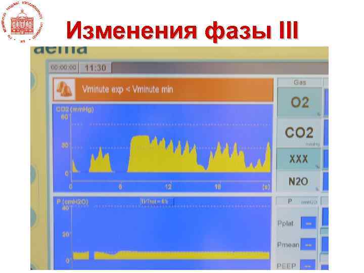 Изменения фазы III 