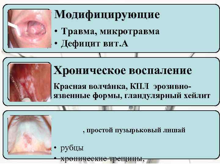 Модифицирующие • Травма, микротравма • Дефицит вит. А Хроническое воспаление , Красная волчанка, КПЛ