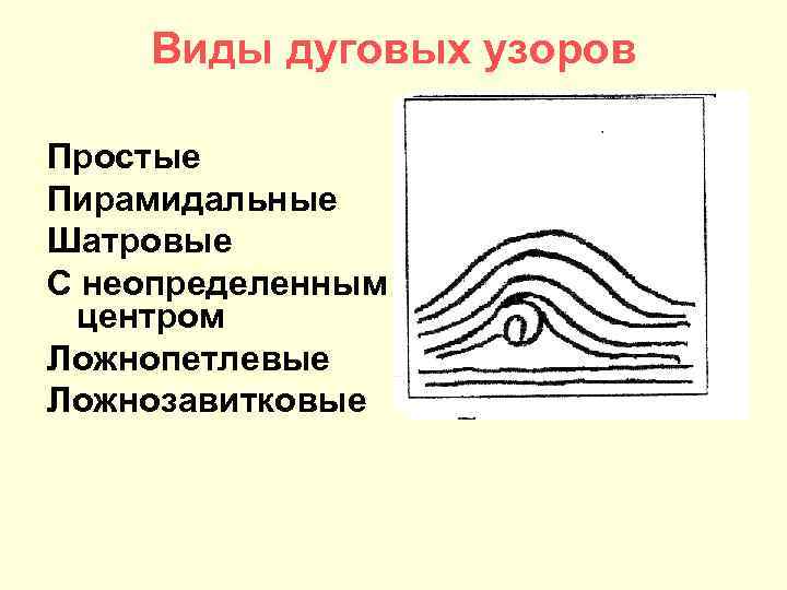 Виды дуговых узоров Простые Пирамидальные Шатровые С неопределенным центром Ложнопетлевые Ложнозавитковые 