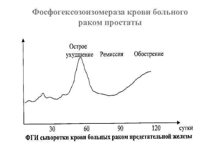 Фосфогексозоизомераза крови больного раком простаты 